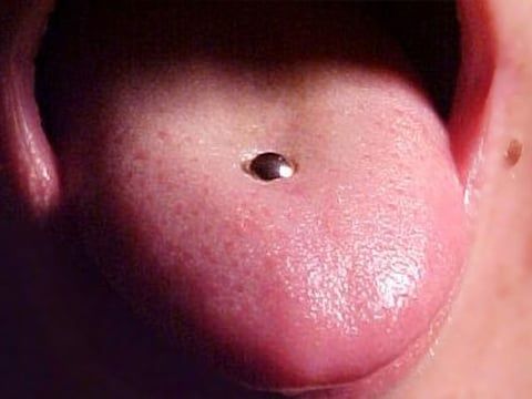 Oral piercing: what are the risks?